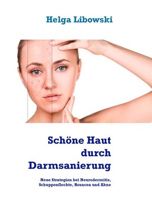 cover image of Schöne Haut durch Darmsanierung